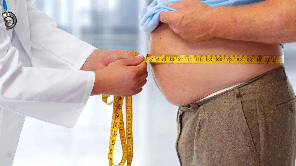 Obezite ve Güncel Tedavisi