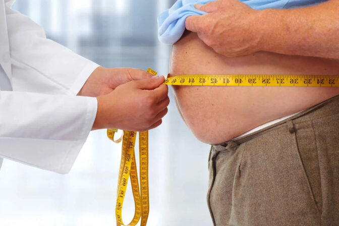 Obezite ve Güncel Tedavisi